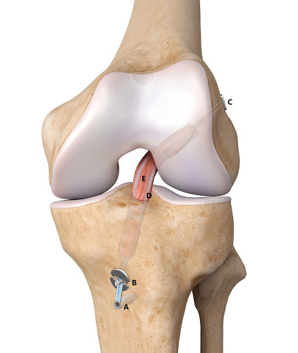 Dr. Omar Perales - Traumatología , Artroscopia y Medicina Deportiva , Fracturas, Emergencias, Cirugías Traumatologicas